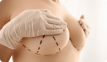 Mamoplastia
