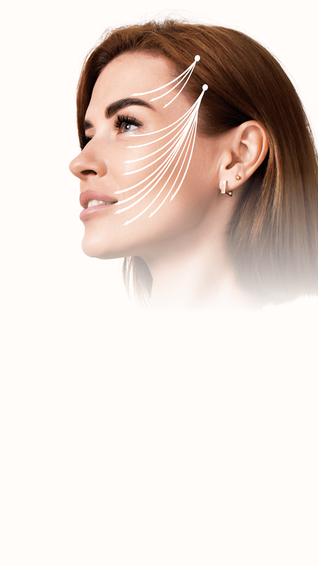 Botox