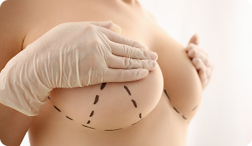 Mamoplastia